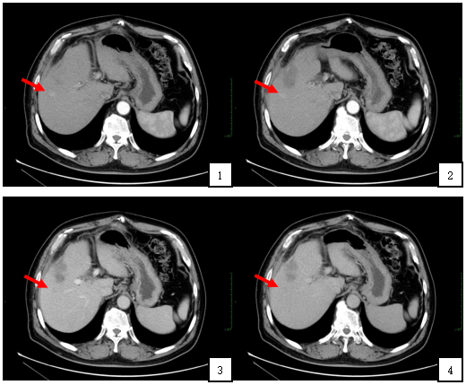 1744960206666011.png 1-4.png