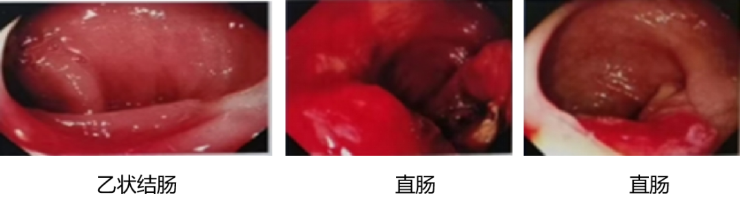 1746595943168114.png 1-3.png