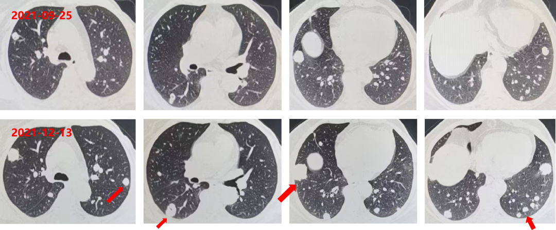 1746596002808205.png 1-11.png