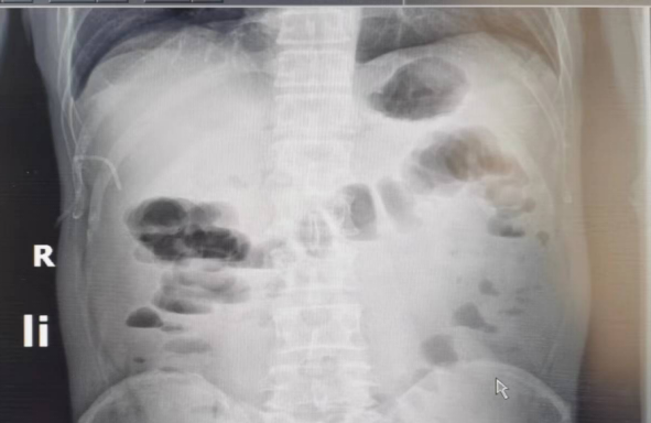 1746597085908925.png 1-17.png