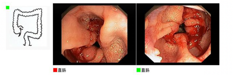 1746597851202736.png 1-2.png