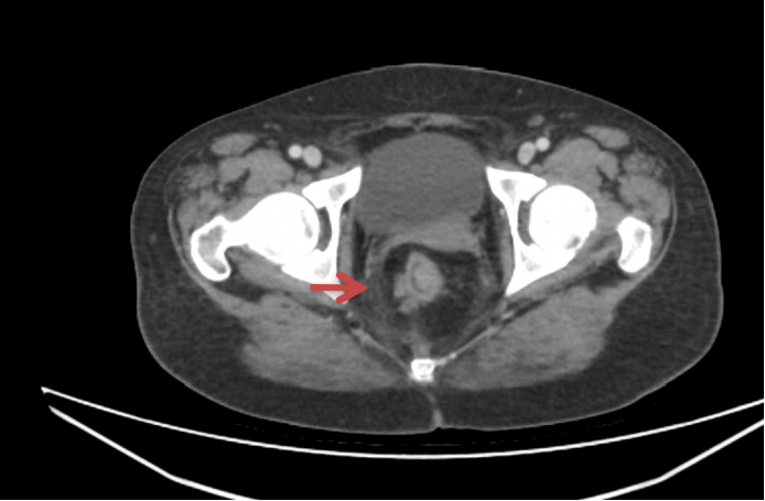 1746597856962899.png 1-3.png