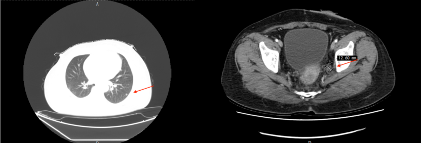 1746597885141847.png 1-7.png