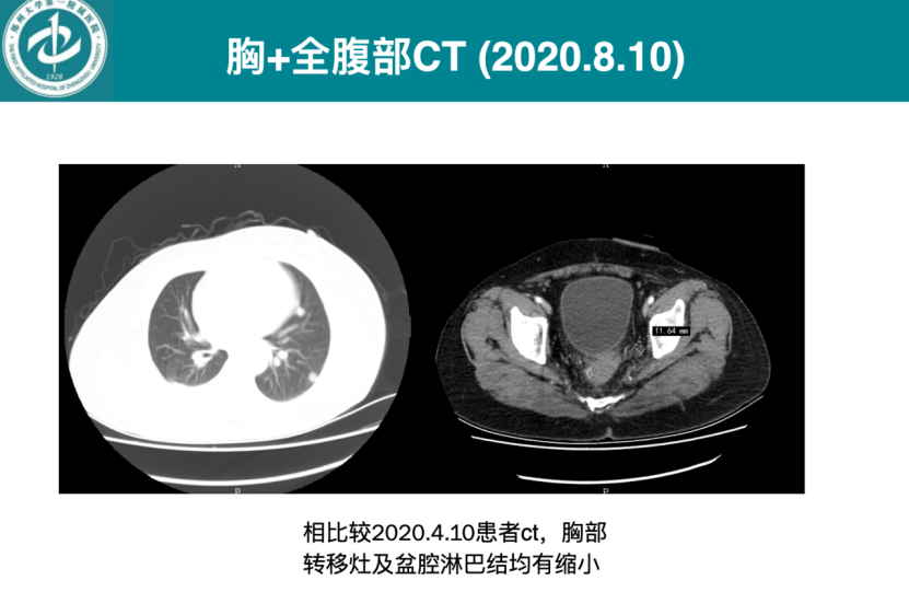 1746597912749196.png 1-11.png