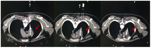 1747791011710303.png 1-3.png