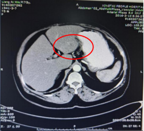 1747792151646282.png 1-2.png