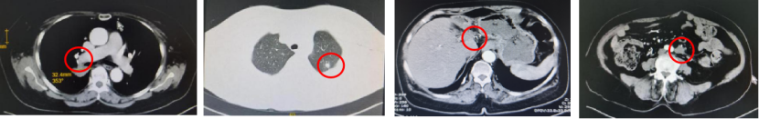 1747792307819888.png 1-13.png