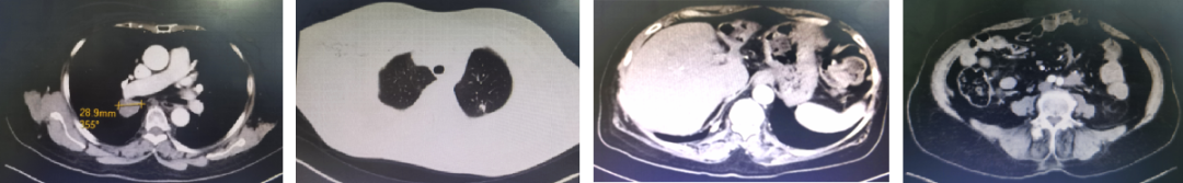 1747792322550608.png 1-15.png