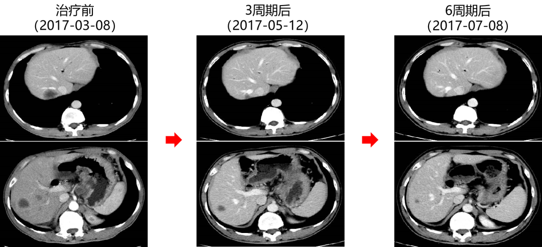 1747792824909908.png 1-4.png