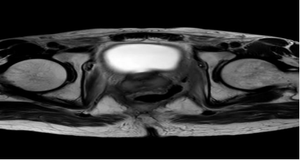 1747793435288440.png 1-12.png