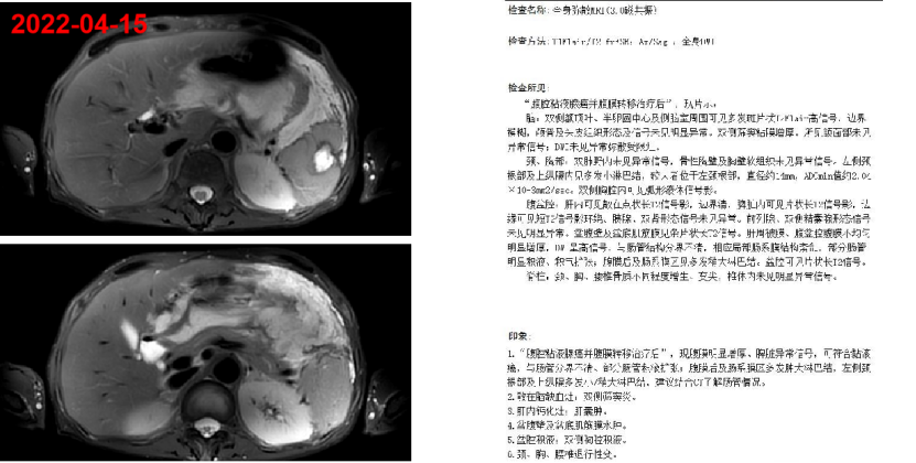 1747794032610217.png 1-6.png