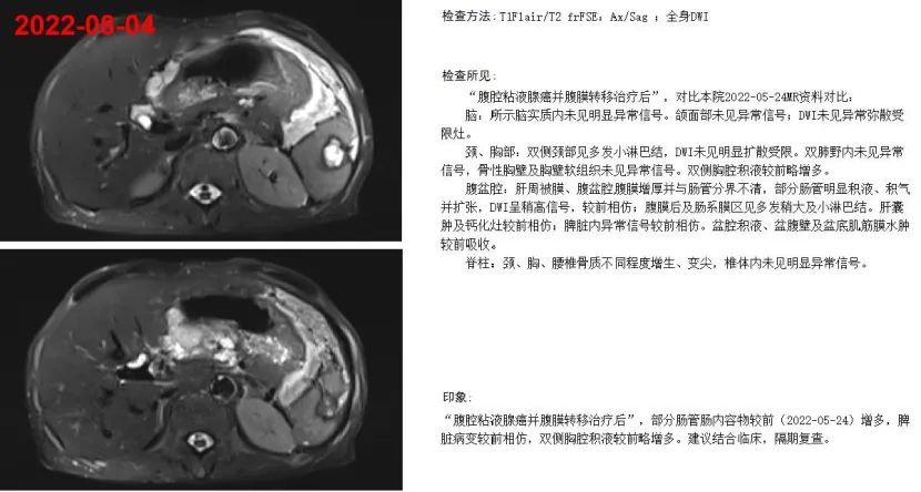 1747794043723787.jpg 1-8.jpg