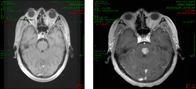 1747794561362007.png 1-5.png