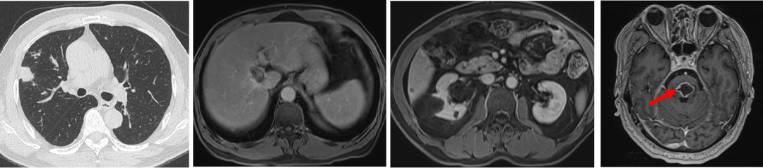 1747794605710690.png 1-8.png