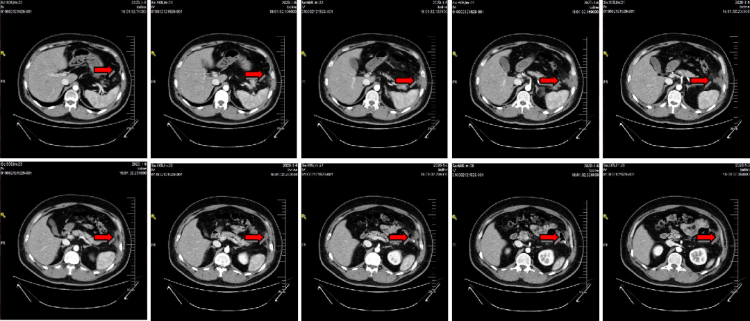 1747795373289282.png 1-2.png