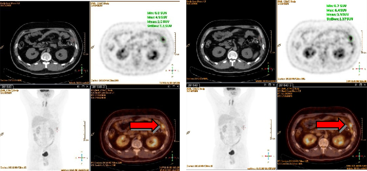 1747795381887056.png 1-3.png