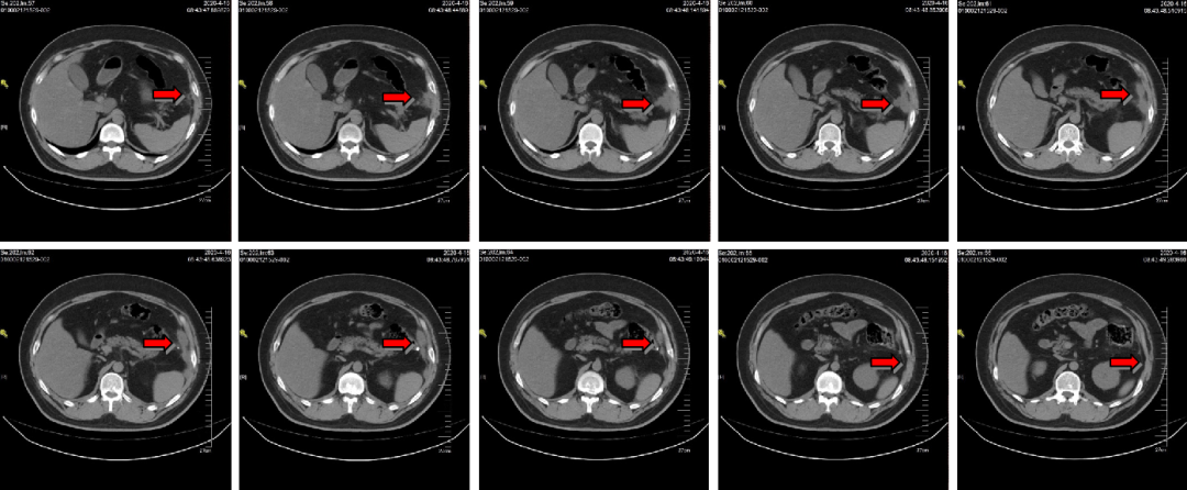 1747795410134603.png 1-4.png