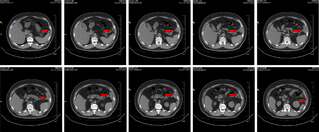 1747795416432338.png 1-5.png