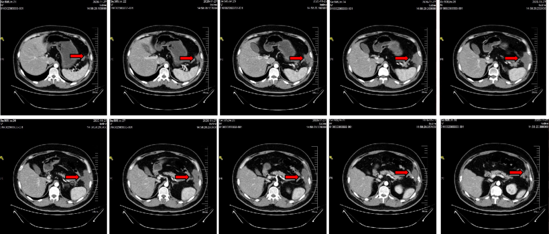 1747795422482704.png 1-6.png