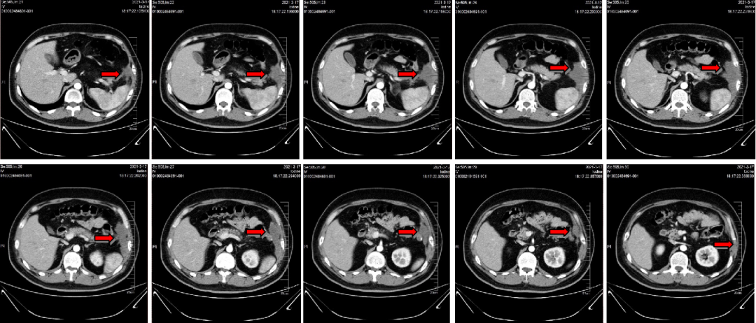 1747795435581627.png 1-8.png