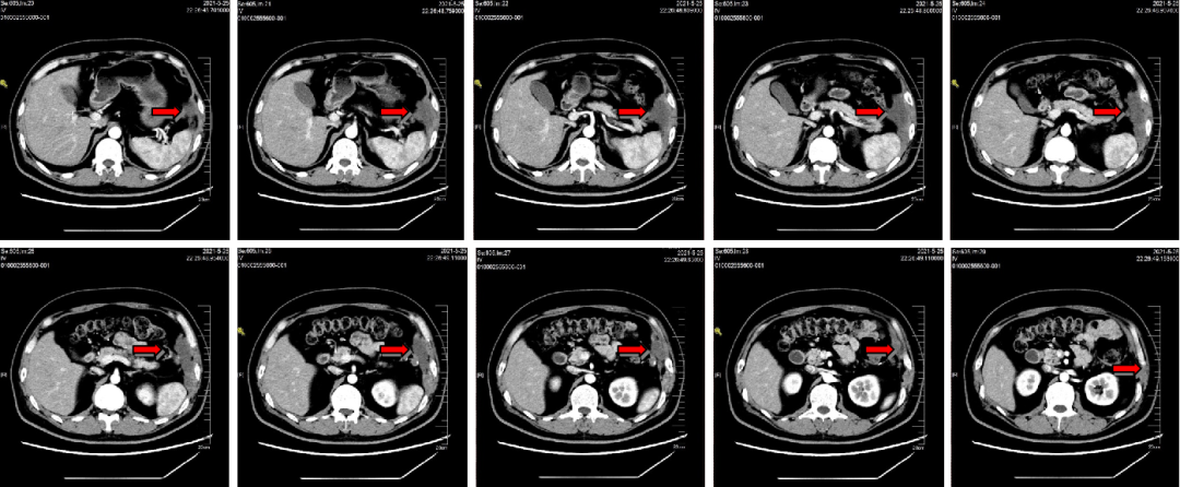 1747795441127605.png 1-9.png