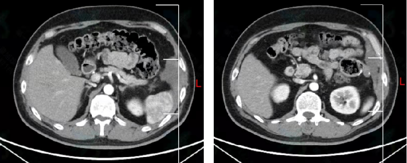 1747795453836515.png 1-11.png