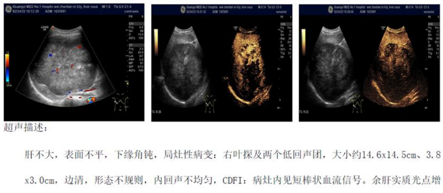 1747796070308780.png 1-2.png