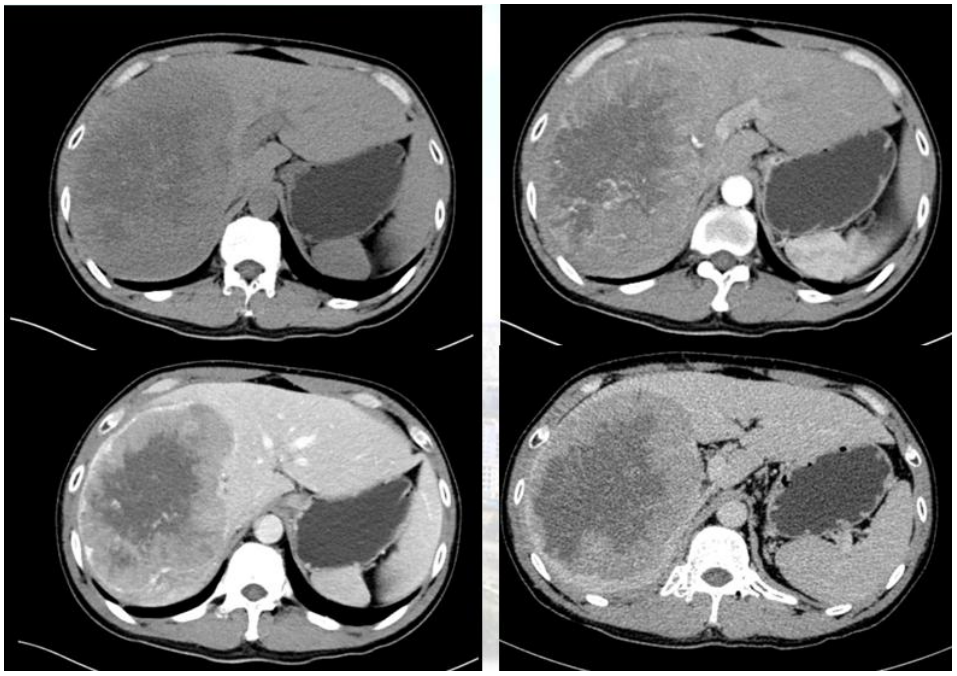 1747796076520676.png 1-3.png