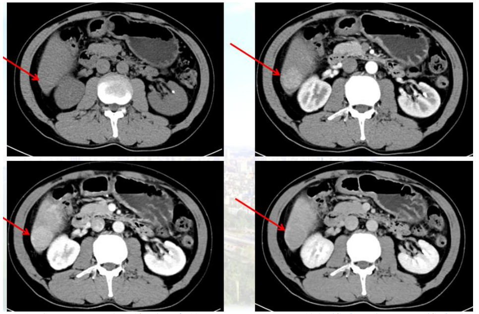 1747796085970527.png 1-4.png