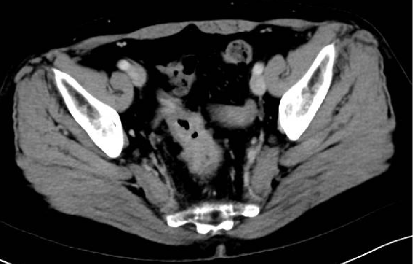 1747797182949399.png 1-5.png