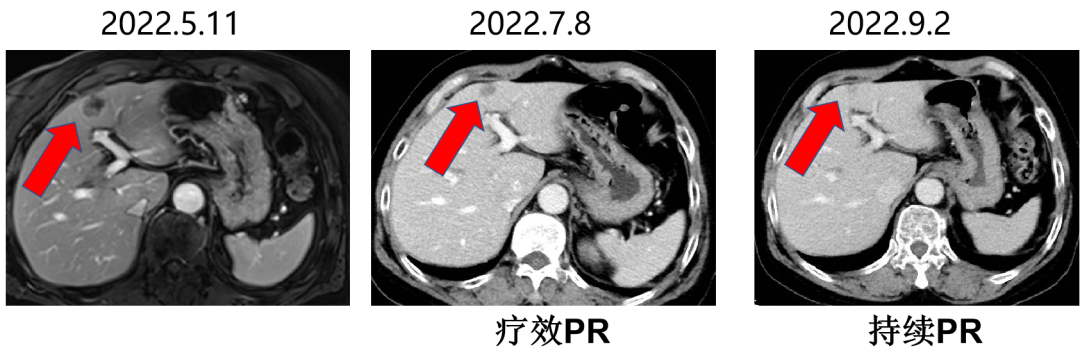 1747797263704569.png 1-13.png