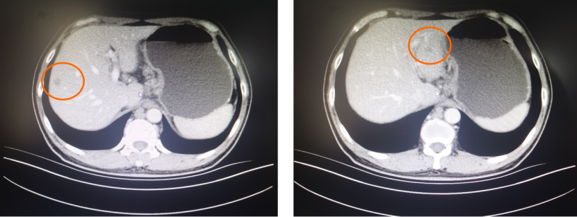 1747797776938243.png 1-4.png