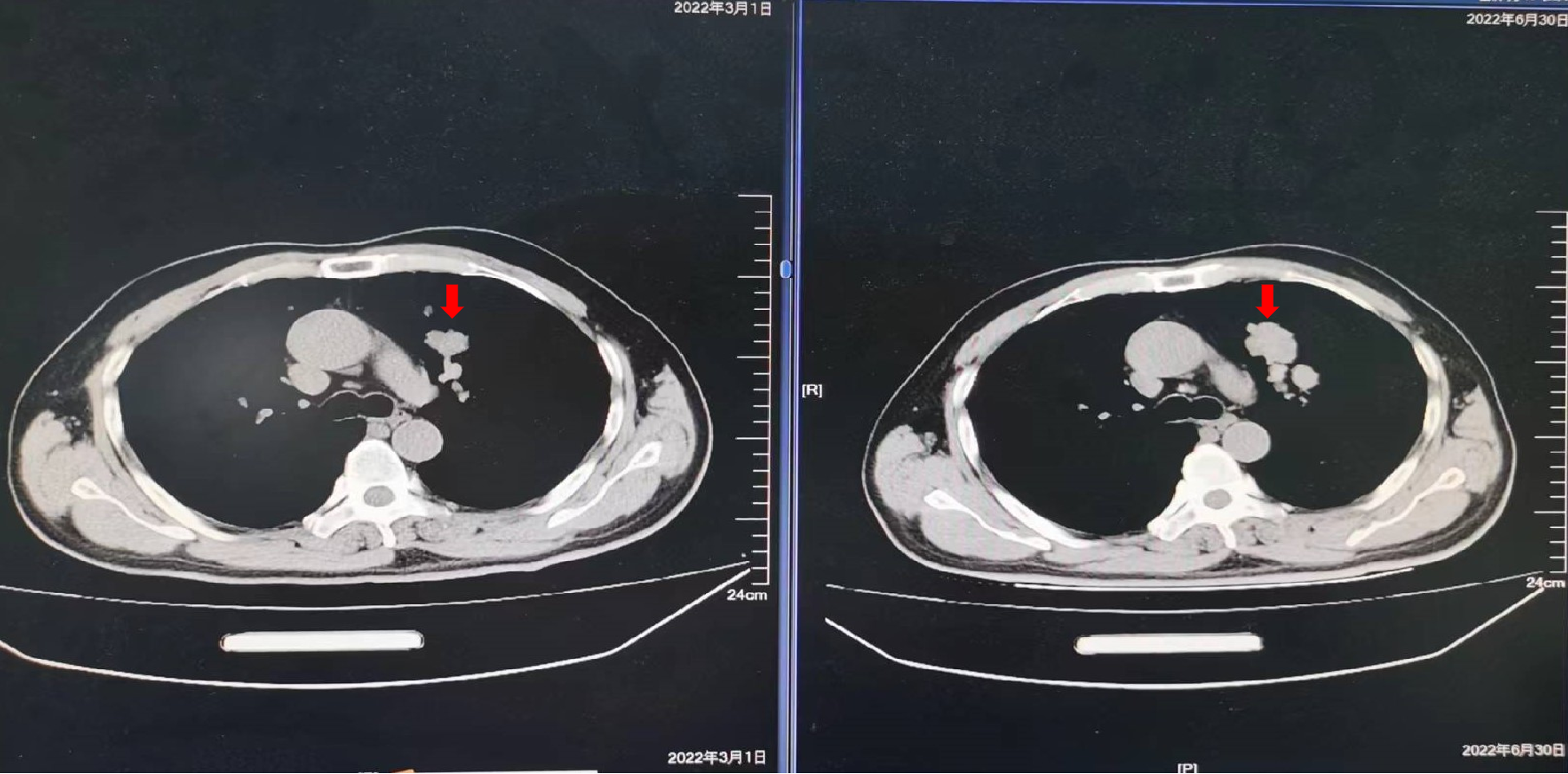 1747798433164393.png 1-9.png