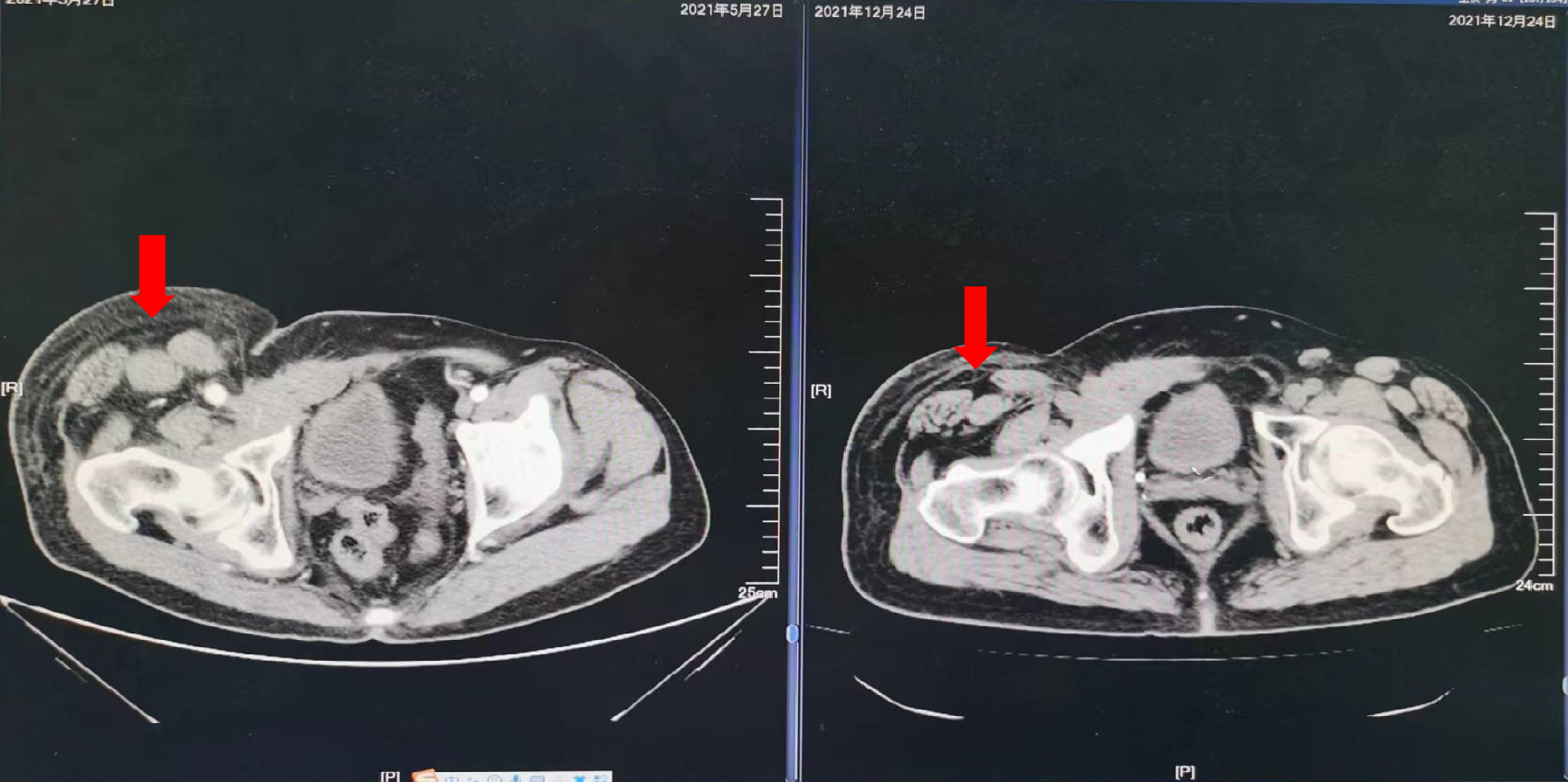 1747798451183663.png 1-12.png