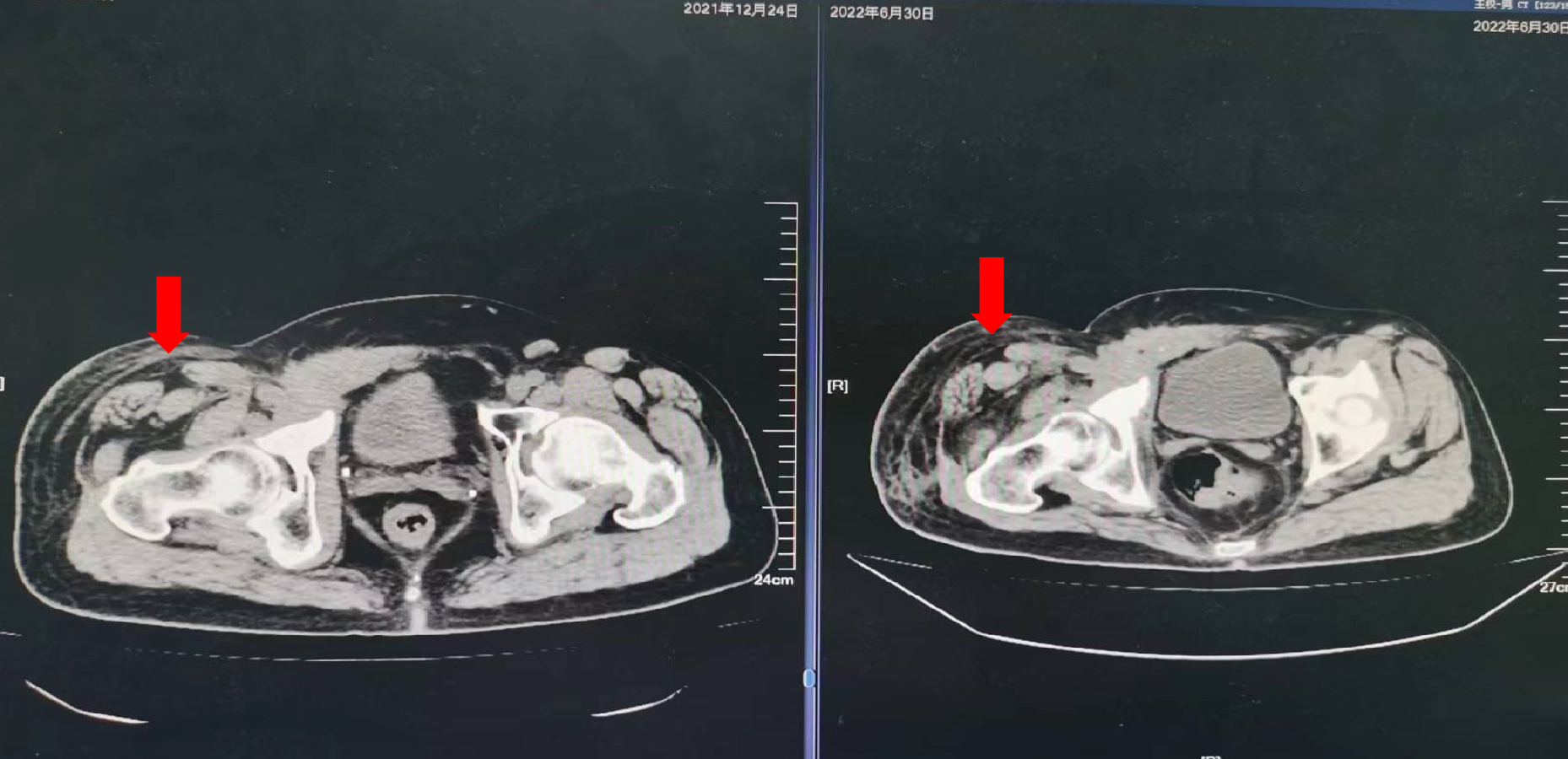 1747798458624055.png 1-13.png