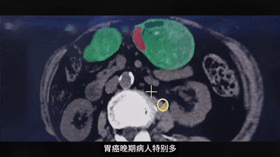 1750906082595052.gif 3-5.gif